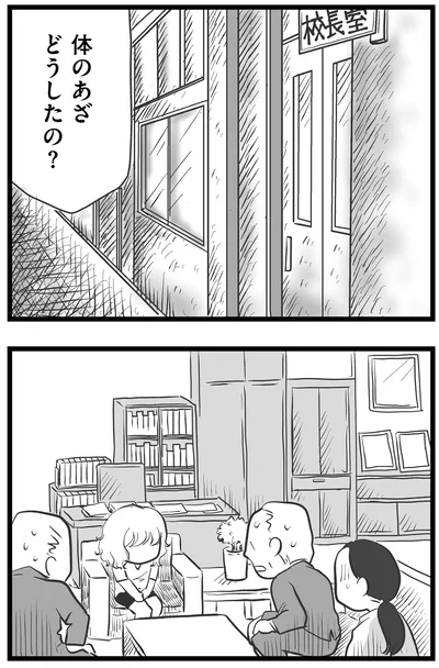 体のあざ、どうしたの？