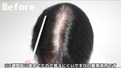 白髪と黒髪のコントラストが目立つ▶驚きのアフターは…！？（⇒次へ）