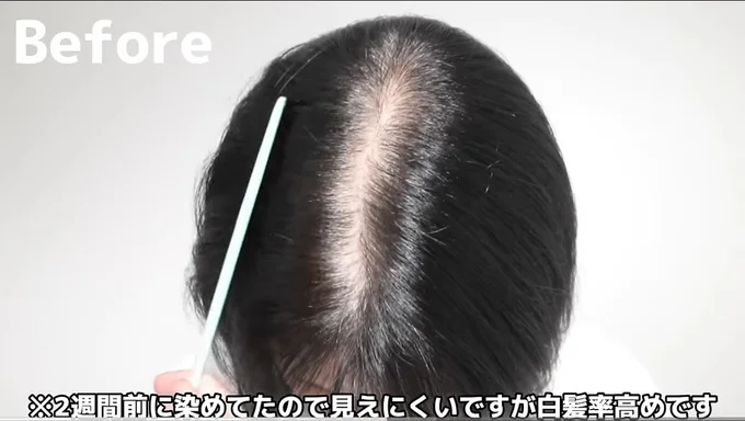 白髪と黒髪のコントラストが目立つ▶驚きのアフターは…！？（⇒次へ）