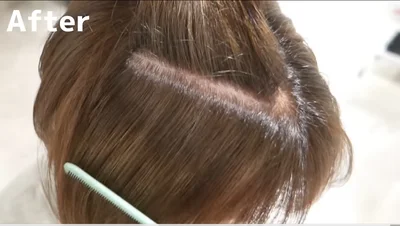 白髪はどこへ！？▶後ろからのビフォーも…（⇒次へ）