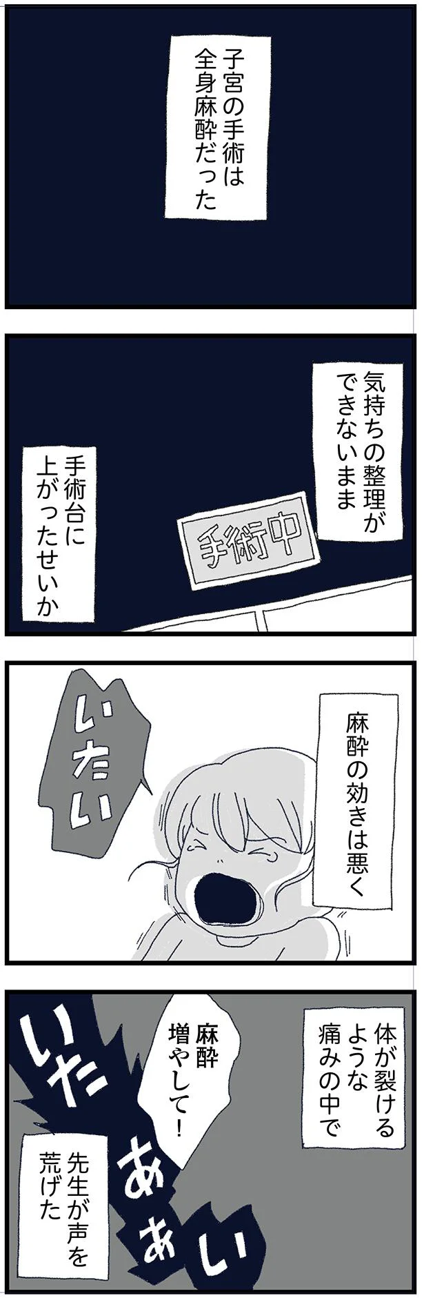 全身麻酔だった