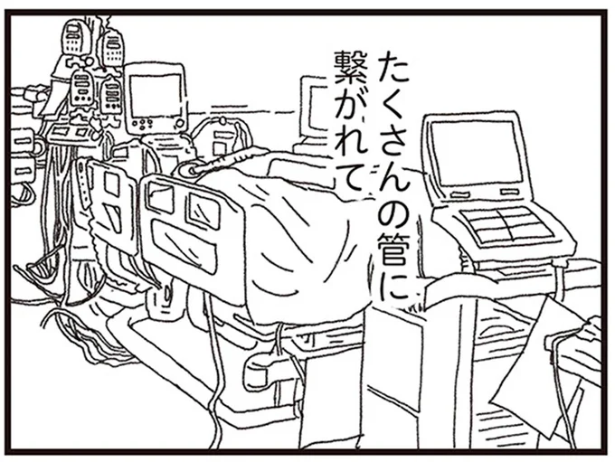 たくさんの管に繋がれて