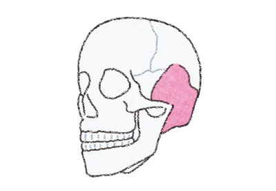 まぶたの重みに「側頭リフト」