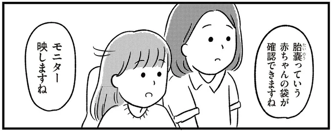 胎嚢っていう赤ちゃんの袋が確認できますね