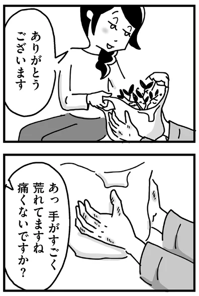 手がすごく荒れてますね