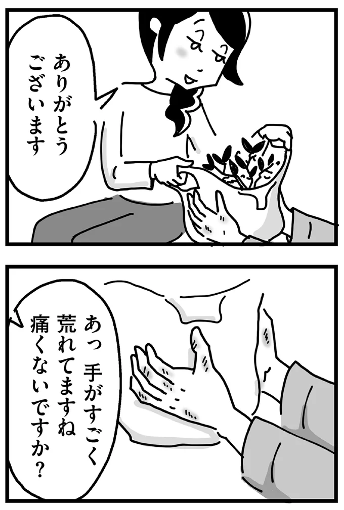 手がすごく荒れてますね