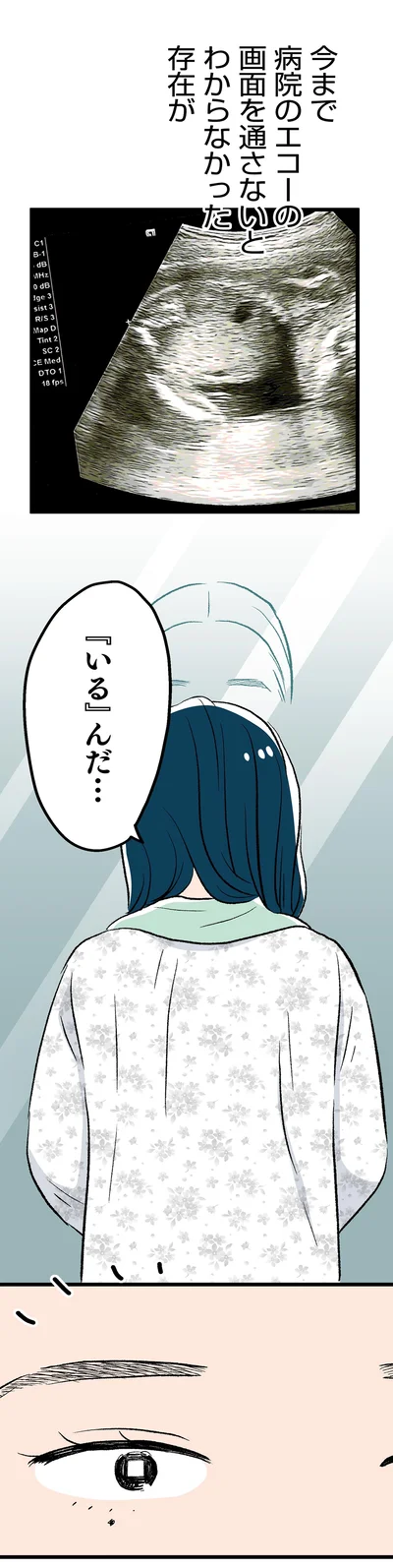 病院のエコーの画面を通さないとわからなかった存在が