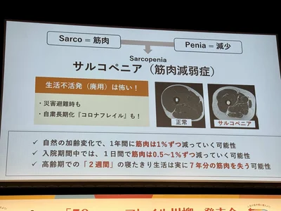 筋肉の衰えを指す「サルコペニア」