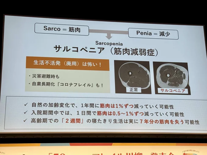 筋肉の衰えを指す「サルコペニア」