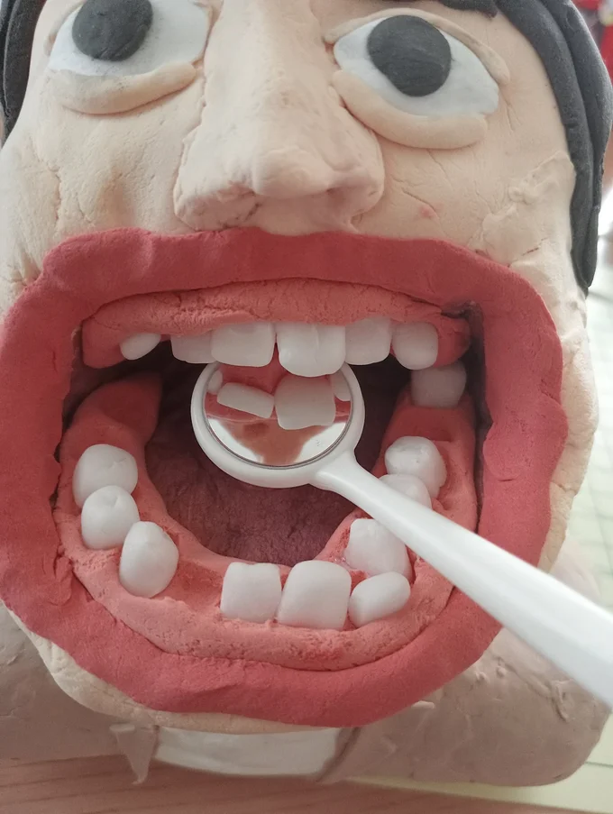 歯医者でよく見る光景ですね。発想がスゴイ…！▶有名人の人形も作ります（⇒次へ）