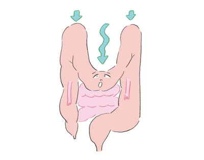 その腸活、実は逆効果かも！？ 便秘がち＆下腹ぽっこり「だら～ん腸タイプ」は要注意！