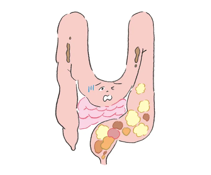 これは避けて！繊維質の食べ物を過剰にとる