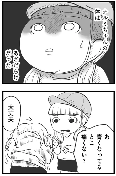 痛くない？
