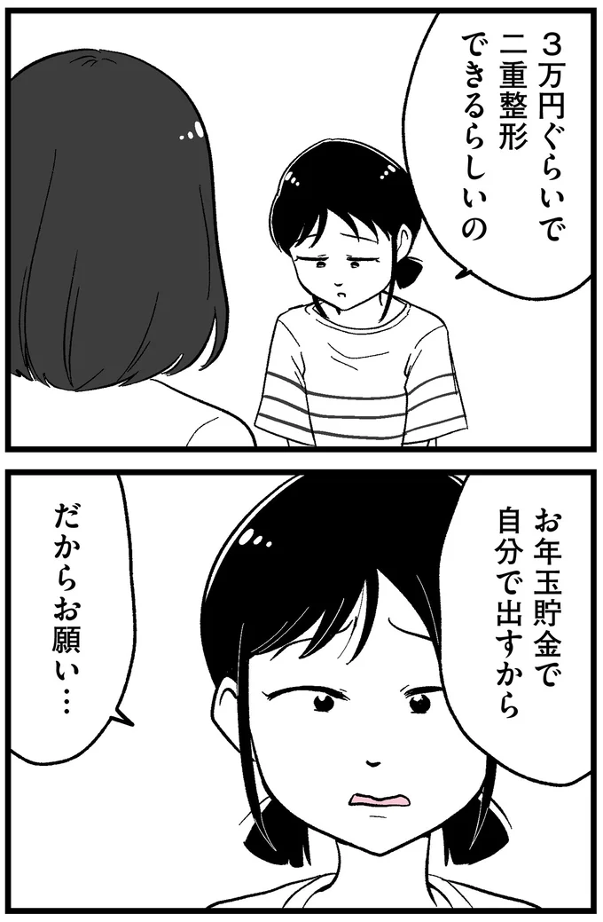 二重整形できるらしいの