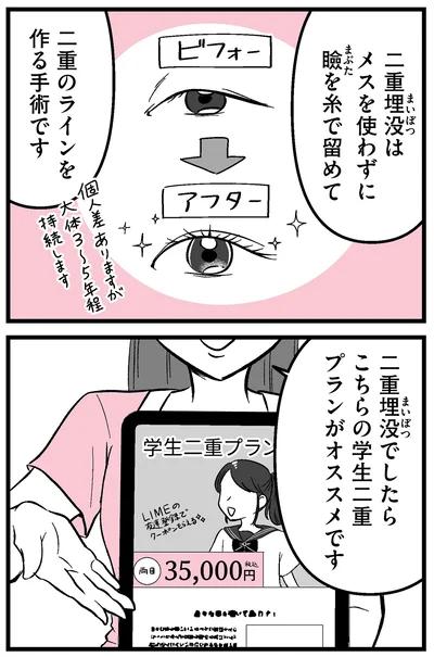 二重埋没は