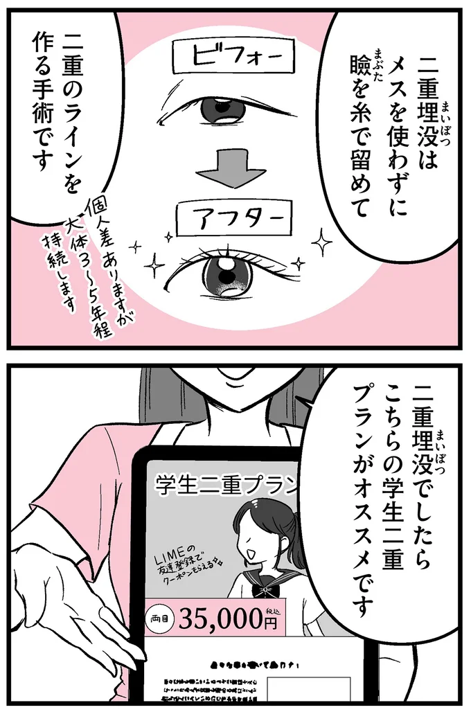 二重埋没は