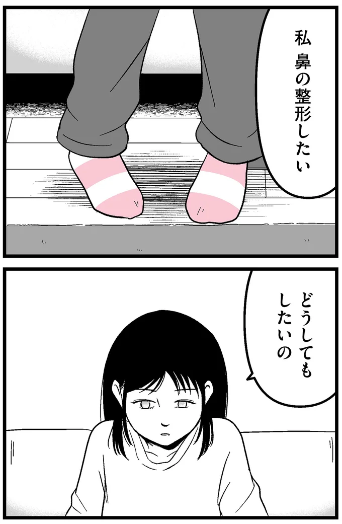 鼻の整形したい