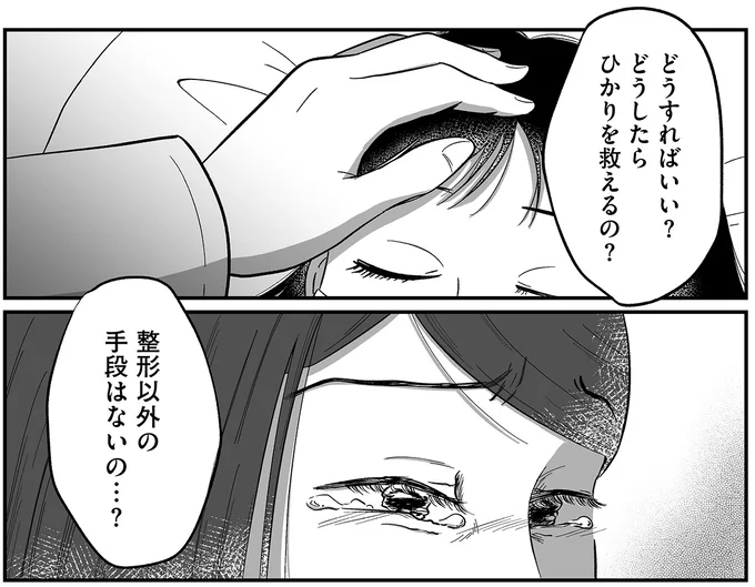 整形以外の手段はないの…?