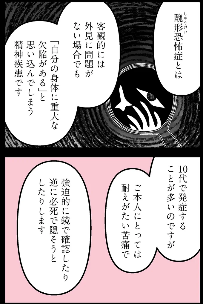 醜形恐怖症とは