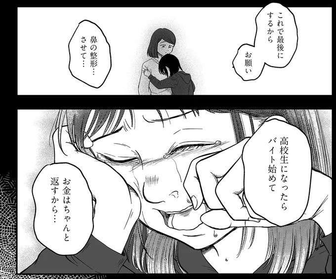 鼻の整形…させて…