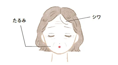 真皮まで届いて将来のシワやたるみの原因に