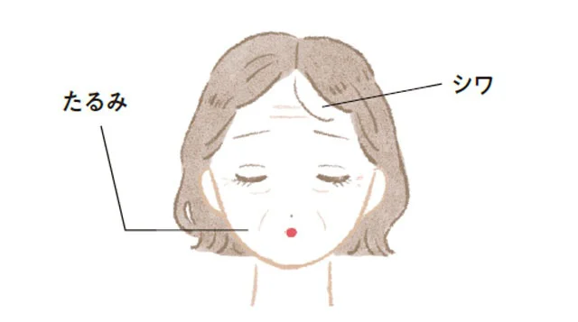 真皮まで届いて将来のシワやたるみの原因に