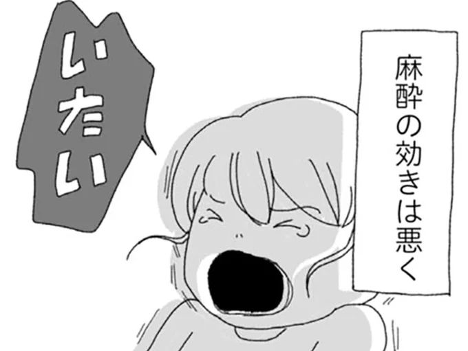 麻酔の効きは悪く…