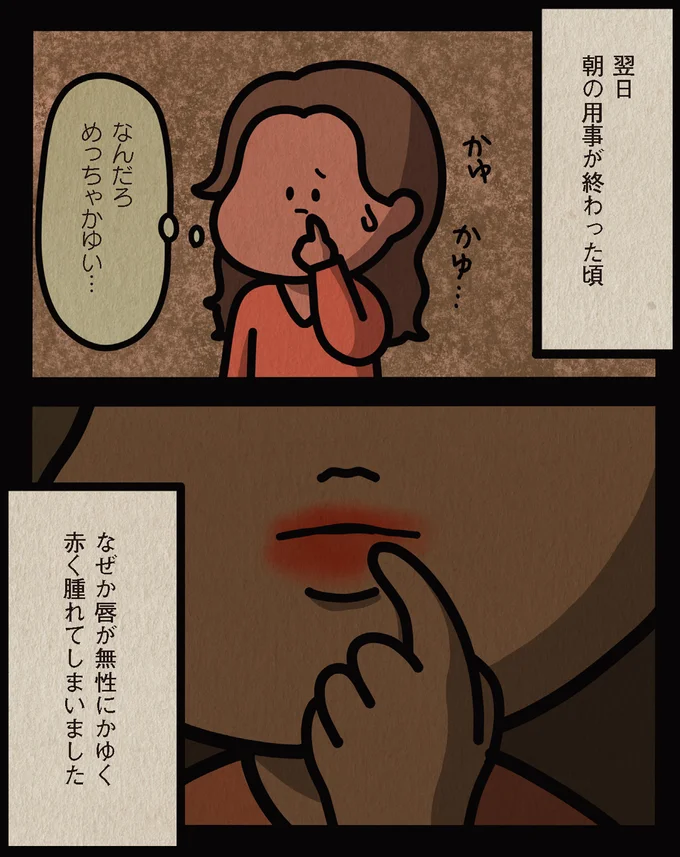 唇が無性にかゆく