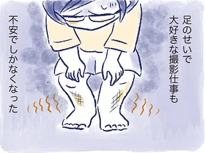 足のせいで大好きな撮影仕事も不安でしかなくなった