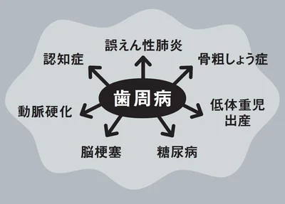 〝汚口〞を放っておくと歯周病から全身疾患に