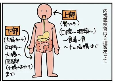 大腸カメラをする外科医の話