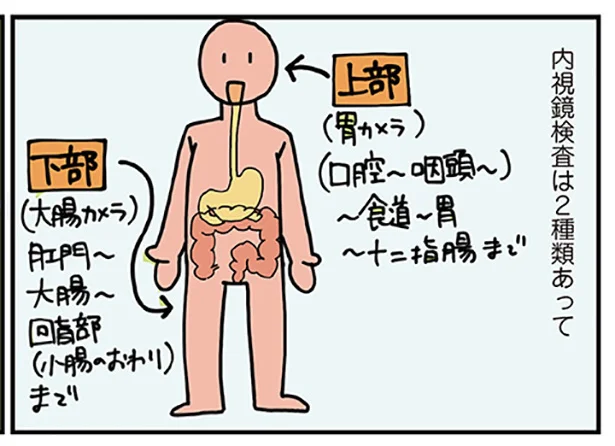 大腸カメラをする外科医の話