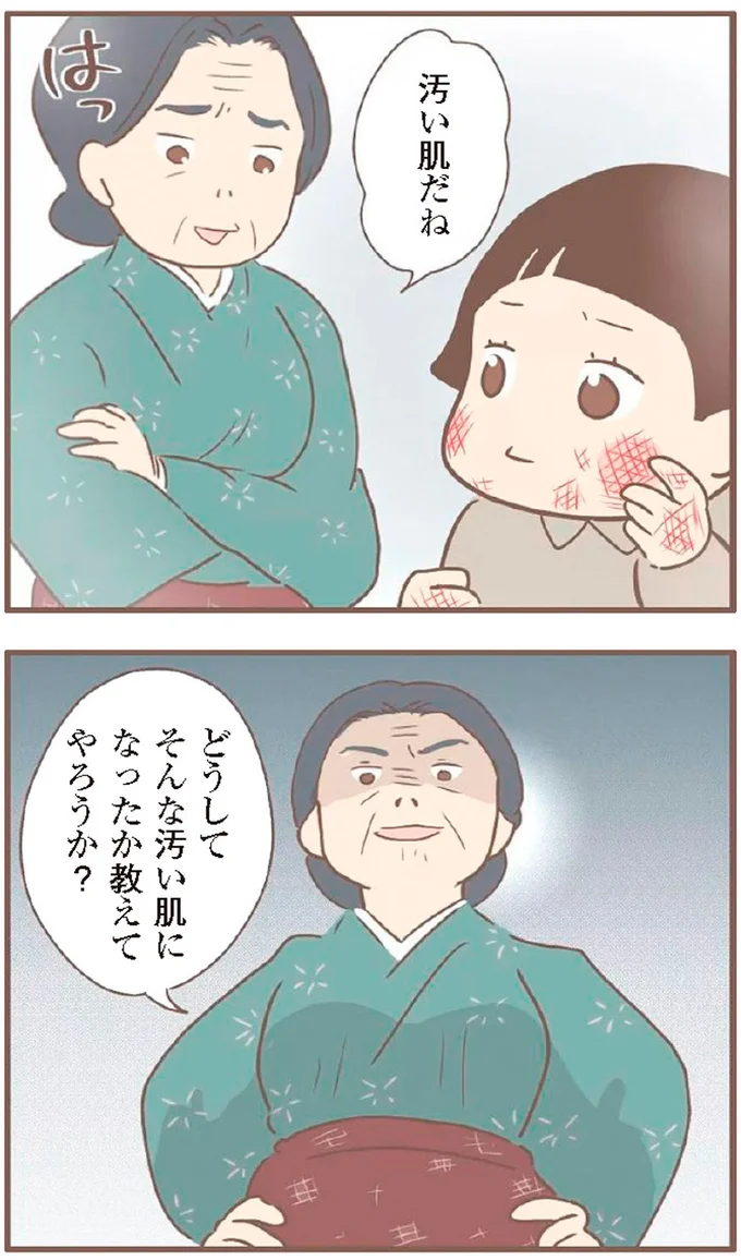 汚い肌だね