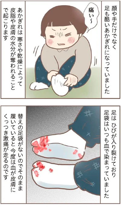 痛い～