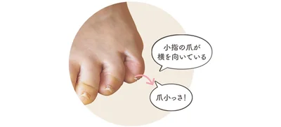 これが寝指