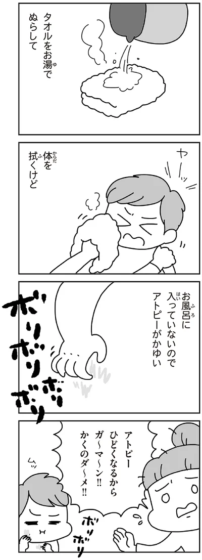 お風呂に入っていないのでアトピーがかゆい