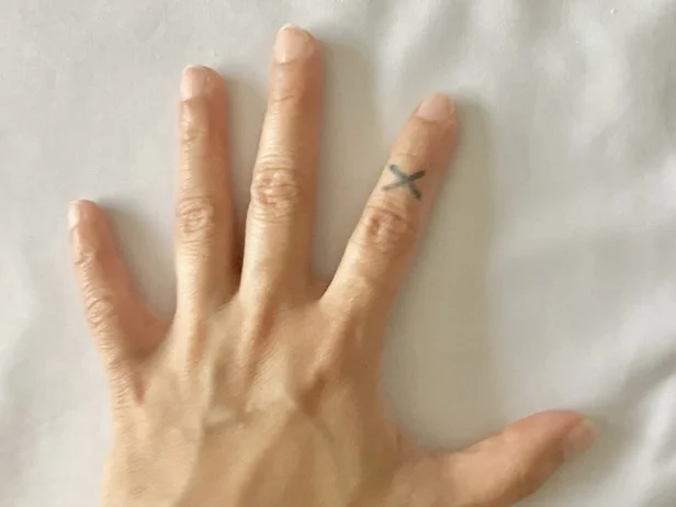 指をケガしたときは…(▶貼り方を見る)