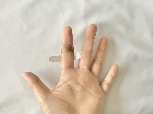 両端から切れ目を入れた粘着テープの上側2本を、関節の上部分でクロス!(▶次へ)