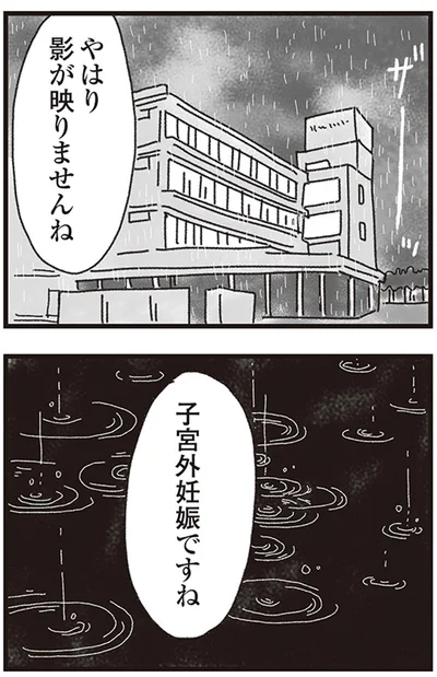子宮外妊娠ですね