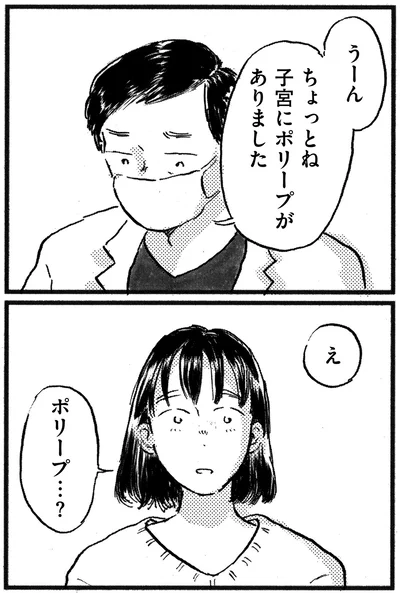 子宮にポリープがありました