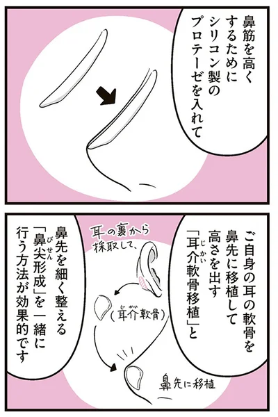 『娘に整形したいと言われたら』より