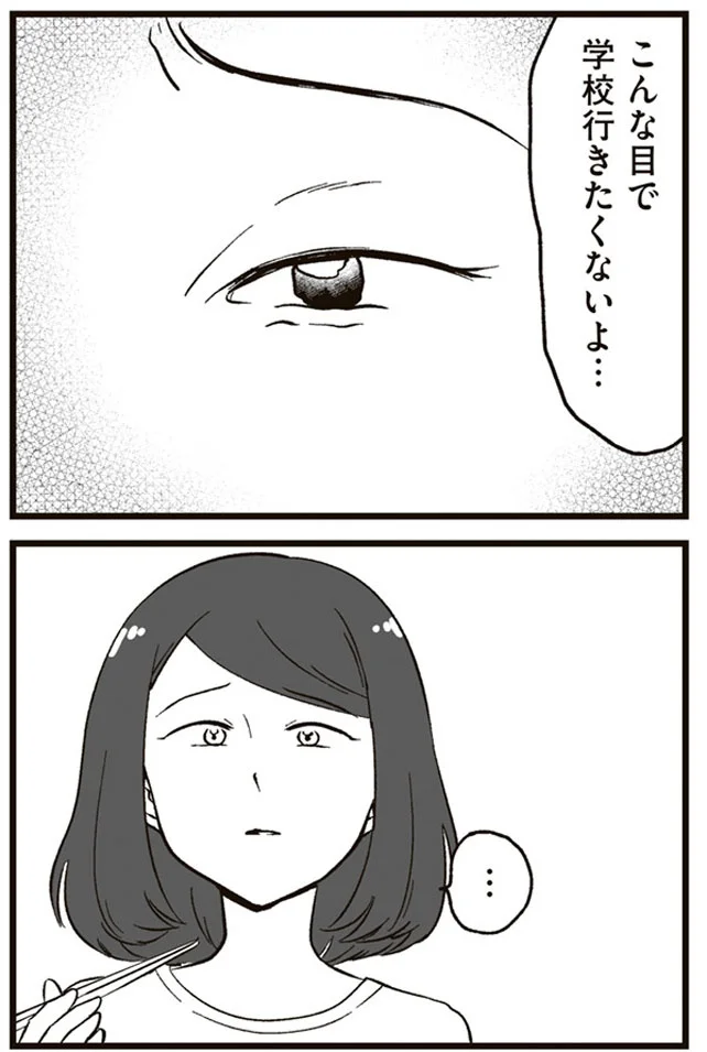 こんな目で学校行きたくないよ...