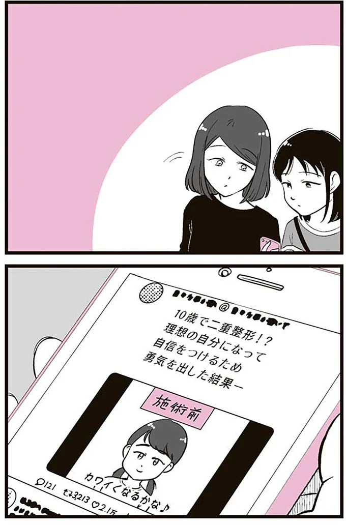 10歳で二重整形!?