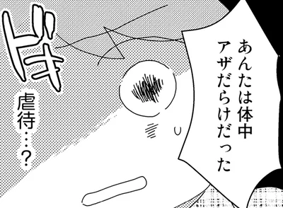 あんたは体中アザだらけだった