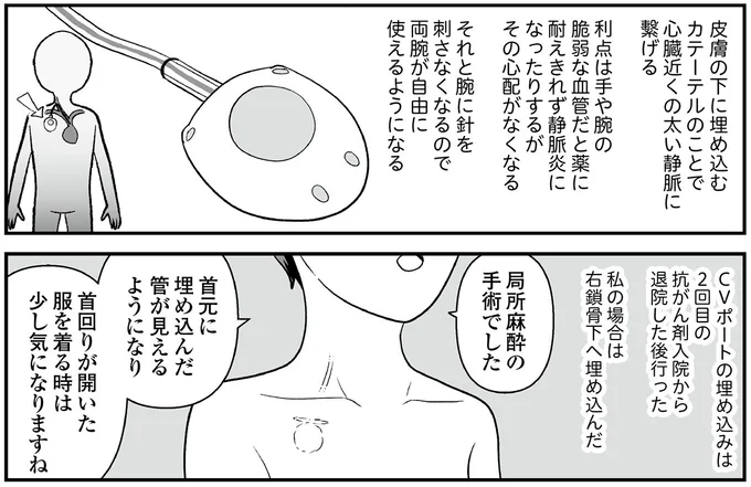 『痔だと思ったら大腸がんステージ4でした 標準治療を旅と漫画で乗り越えてなんとか経過観察になるまで』より