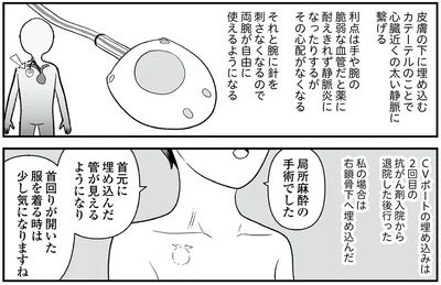 CVポートとは