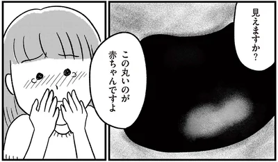 この丸いのが赤ちゃんですよ
