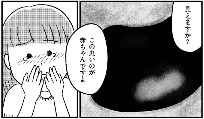 この丸いのが赤ちゃんですよ