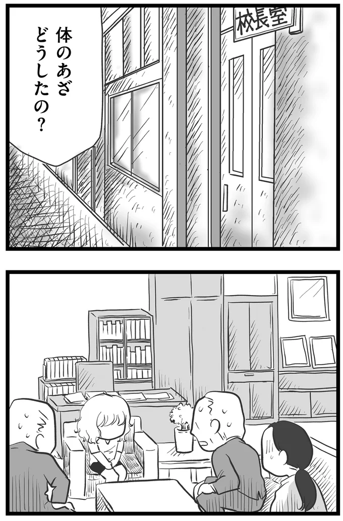 体のあざ、どうしたの？