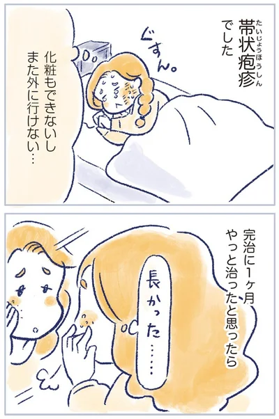 帯状疱疹でした